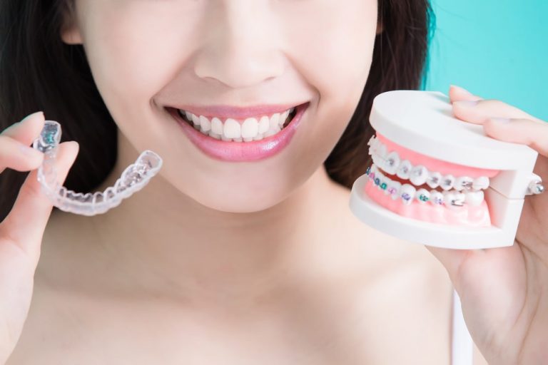 Invisalign et autres techniques Elisabeth Narcy